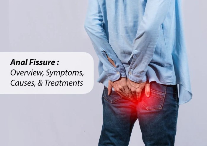 Anal fissure symptoms diagnosis causes treatment what Anal fissure symptoms diagnosis causes treatment what
